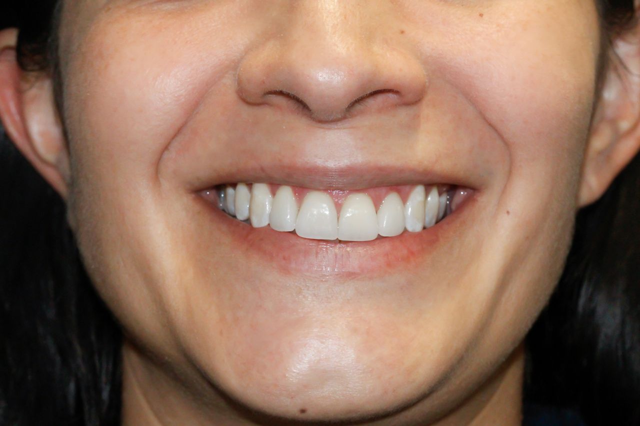 Ilse Méndez Reguera-0