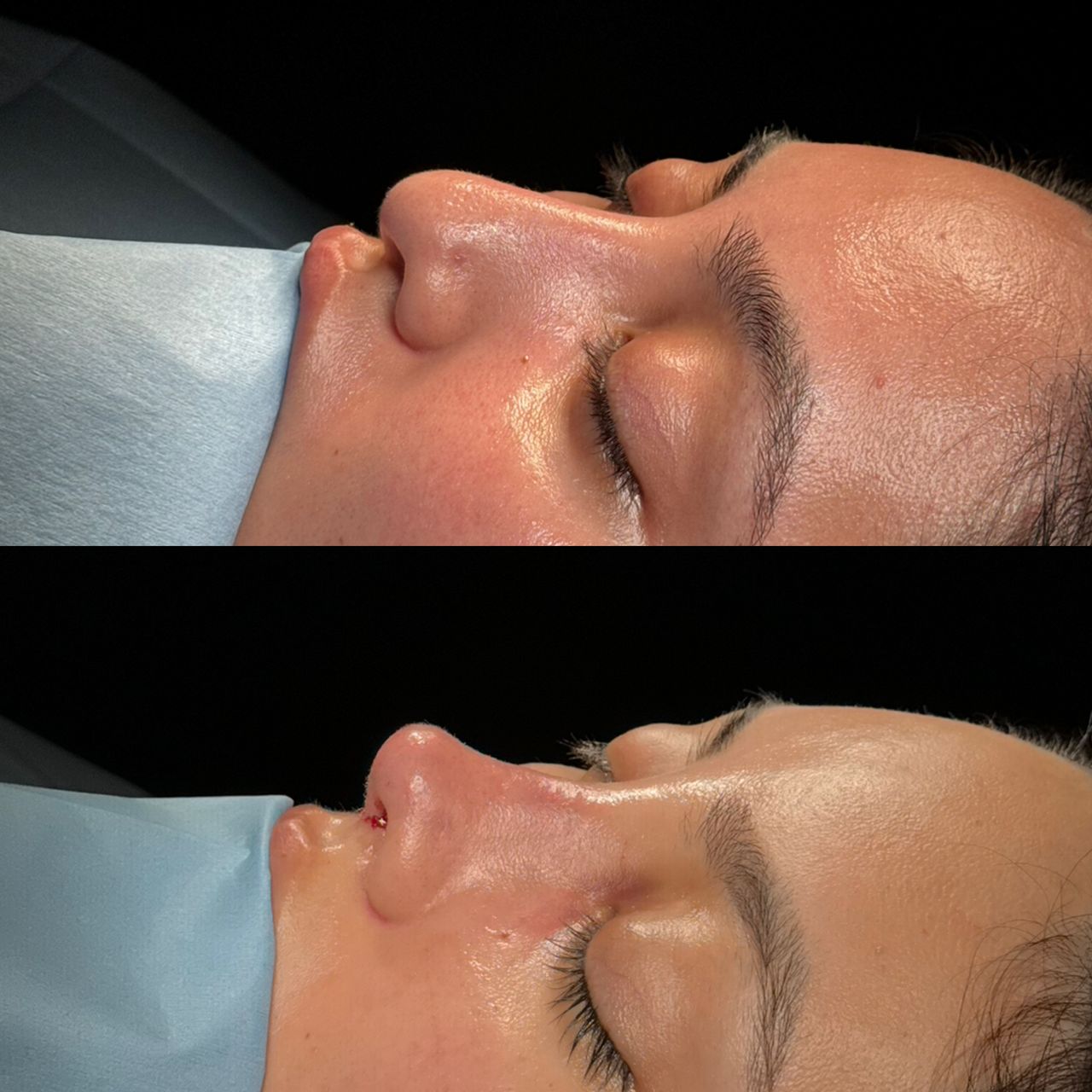 Angel Castro Urquizo-107