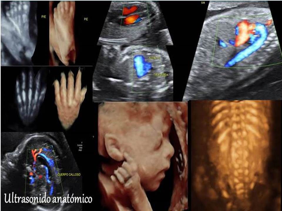 Edgar Alejandro Támez Cristerna-5