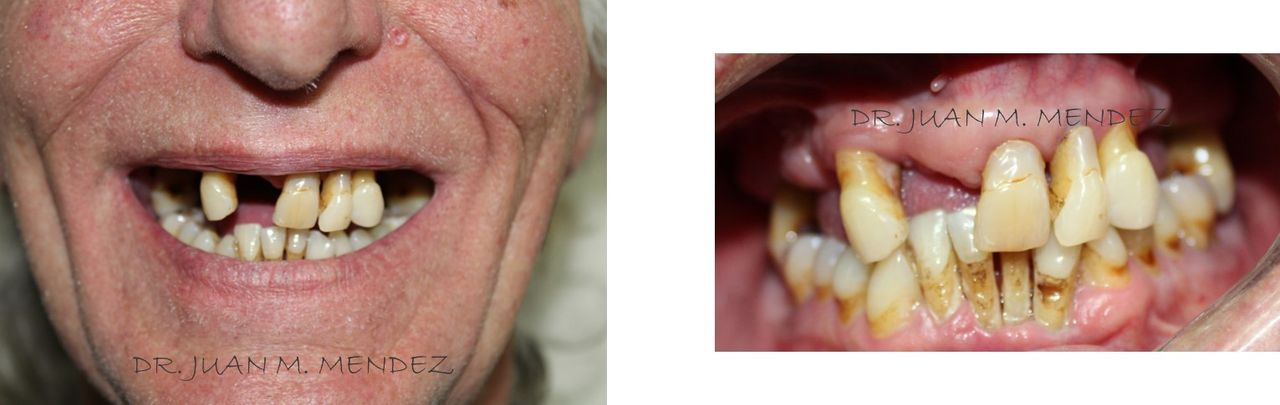 Juan Manuel Méndez Ferrusco-8