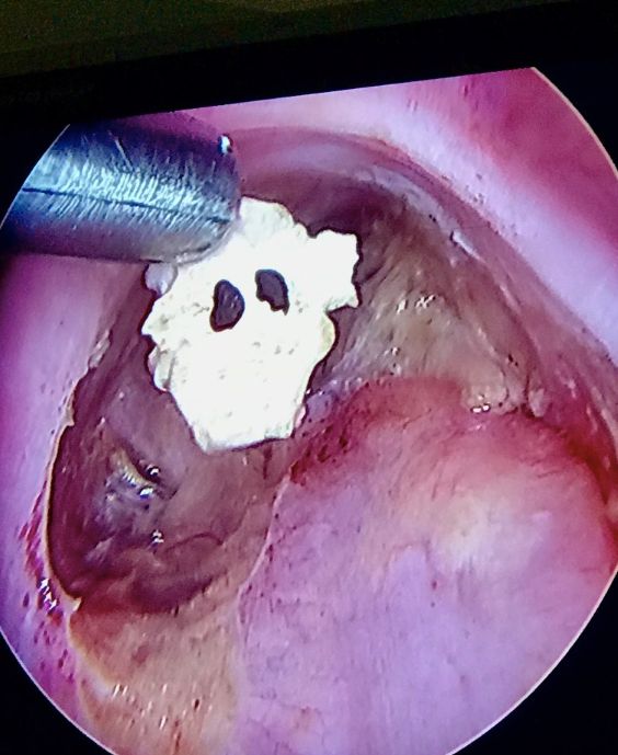 Griselda Reyes Torres-99