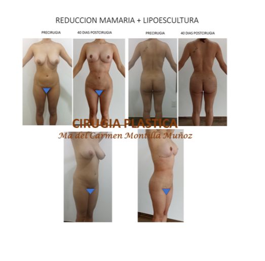 María Del Carmen Montilla Muñoz-11