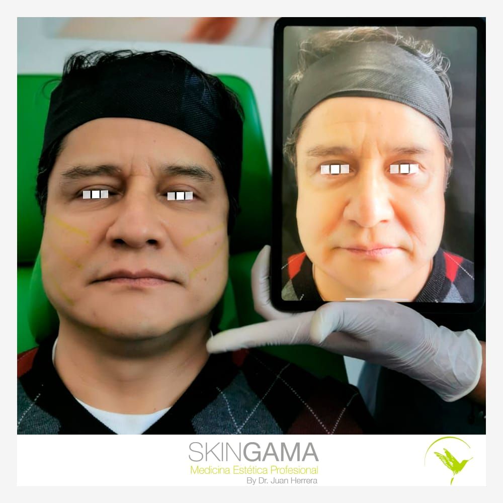 Juan Herrera Hernández-43