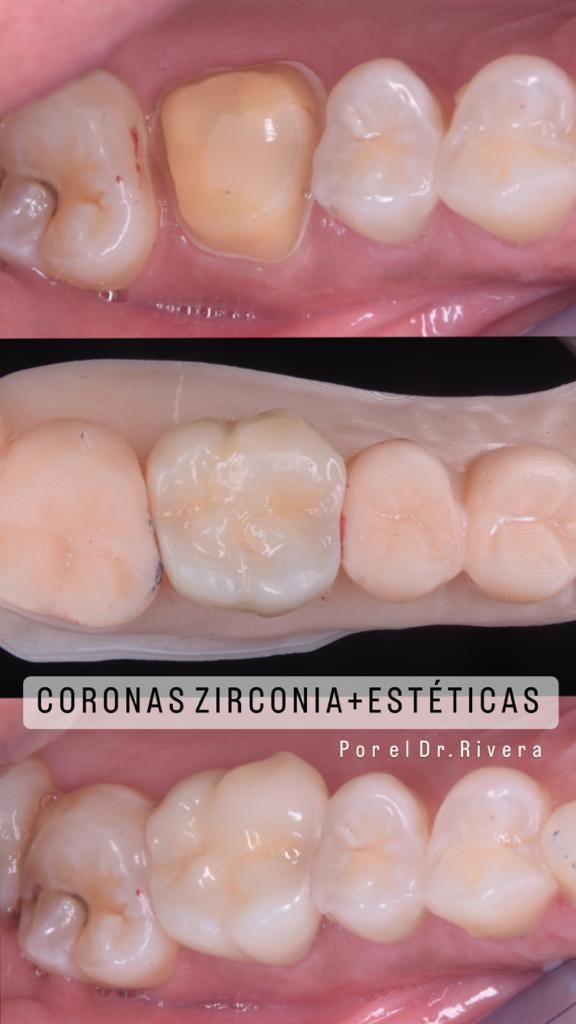 Luis Eduardo Rivera-62