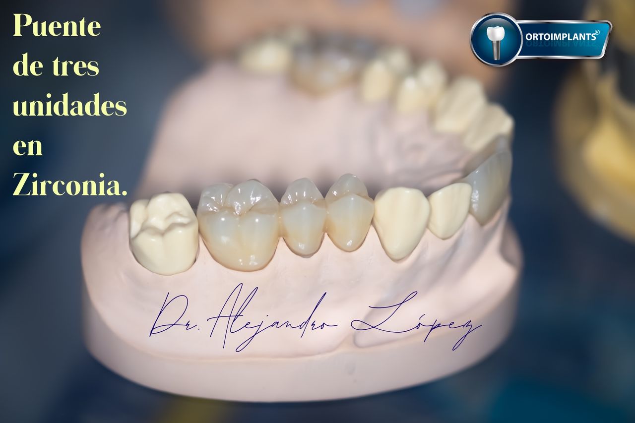 Javier Alejandro López García-23