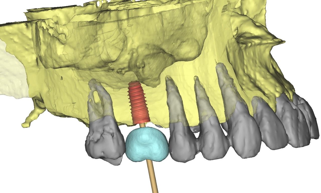 Ireri García Santana-14