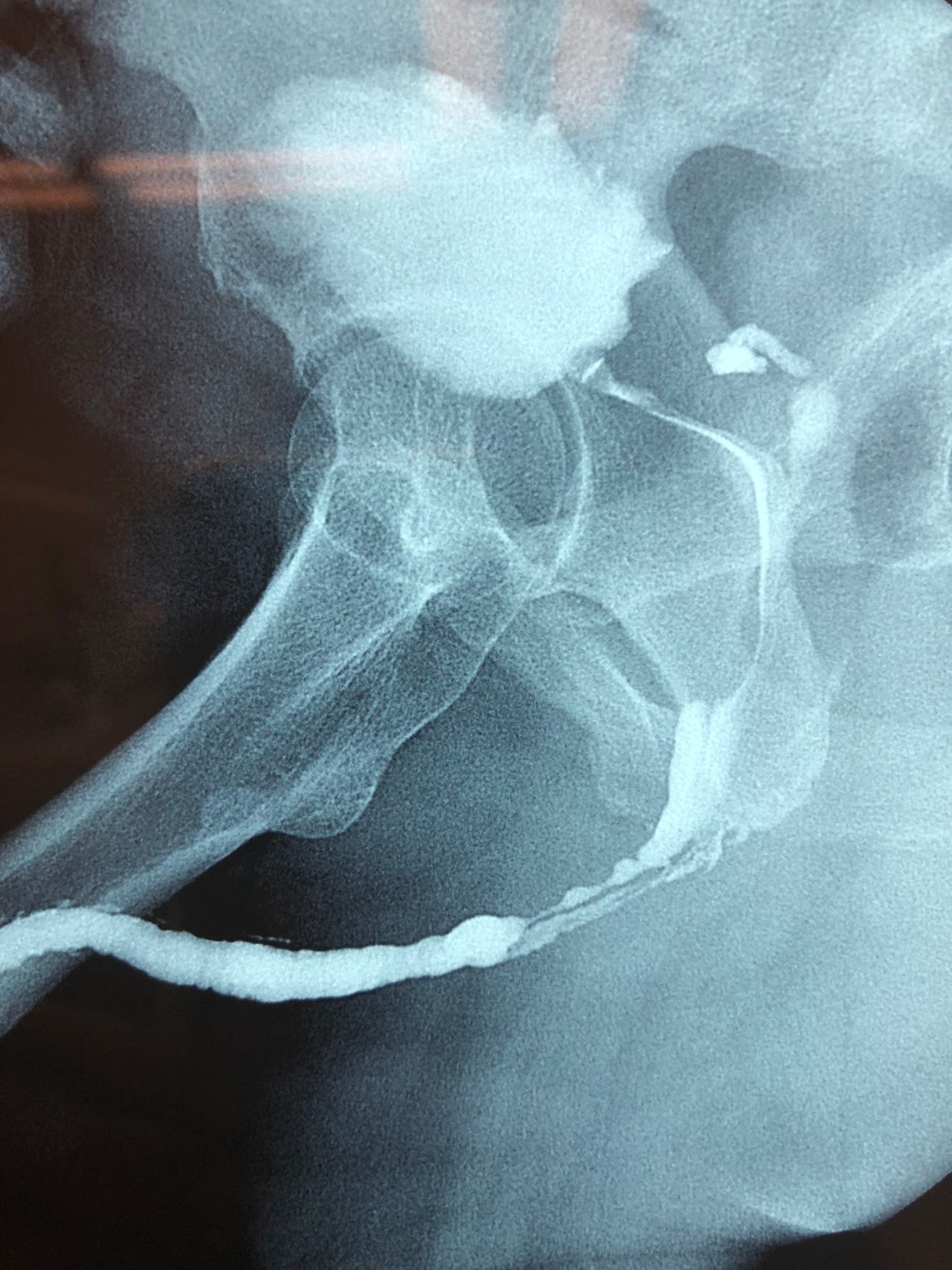 Roberto Juvenal Pérez Avila-8