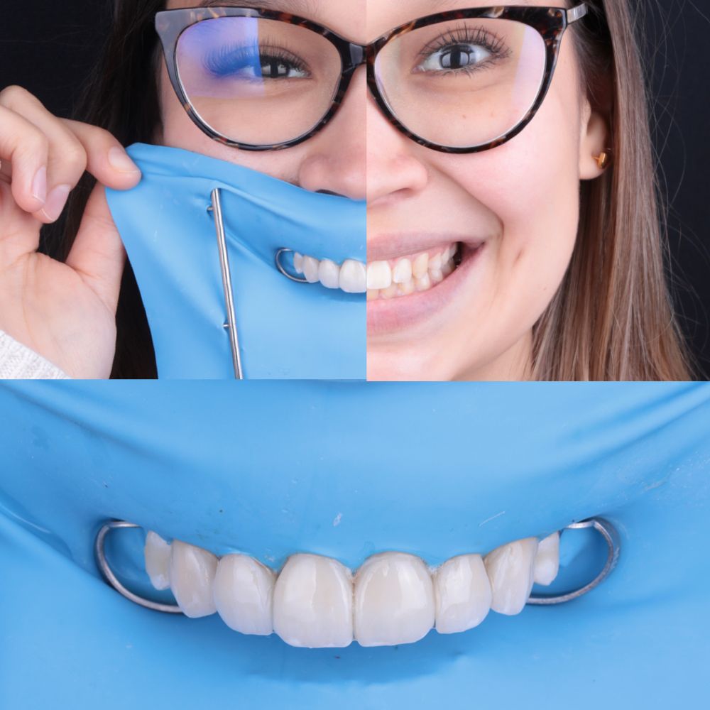 Itzel Abigail Montiel Garces-3