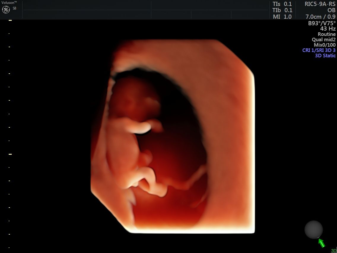 Griselda Reyes Torres-21