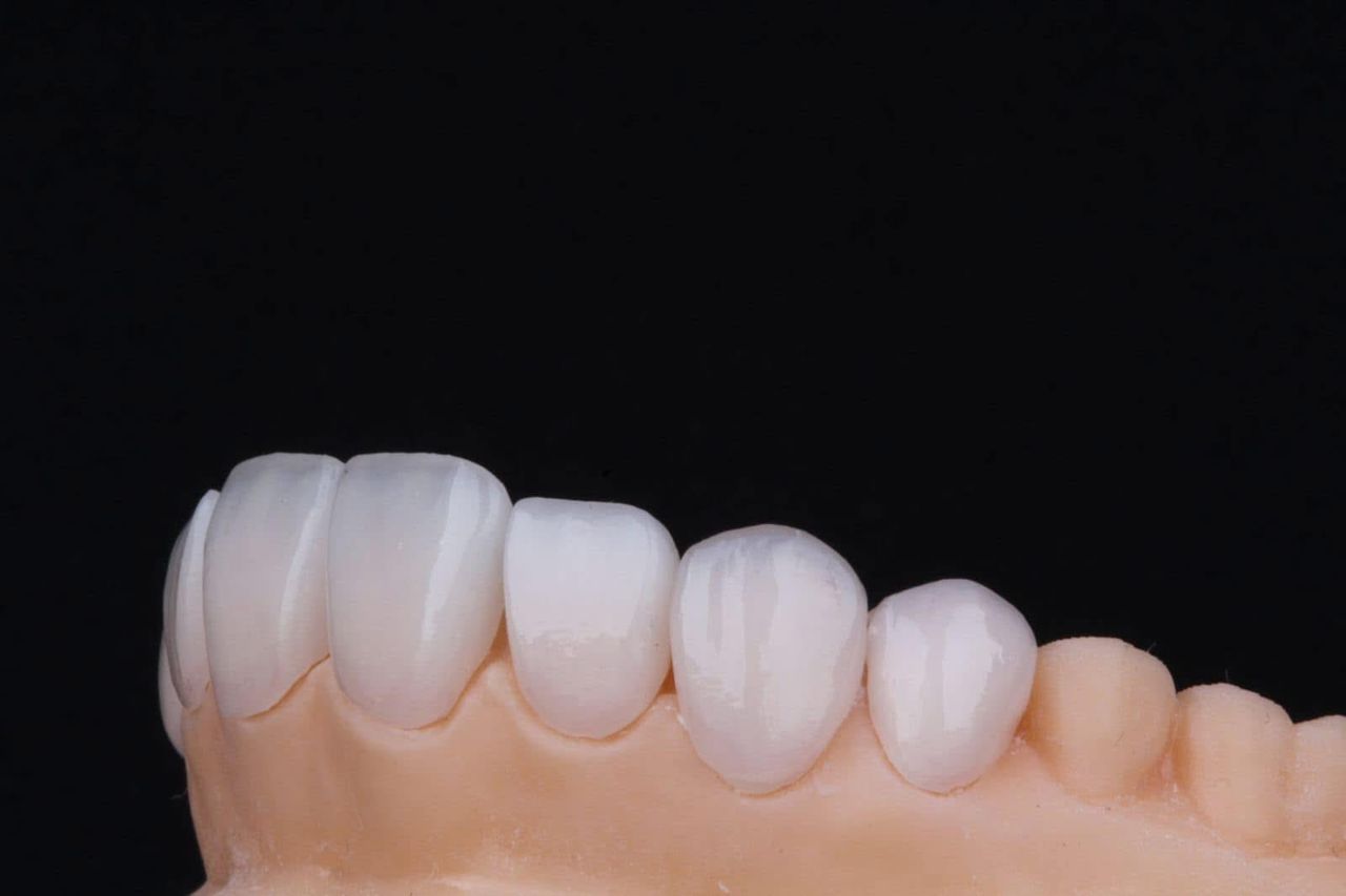 Alexandro Castrellon-8