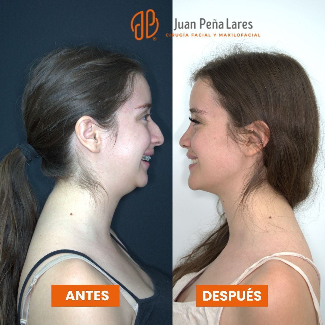 Juan Peña Lares-12