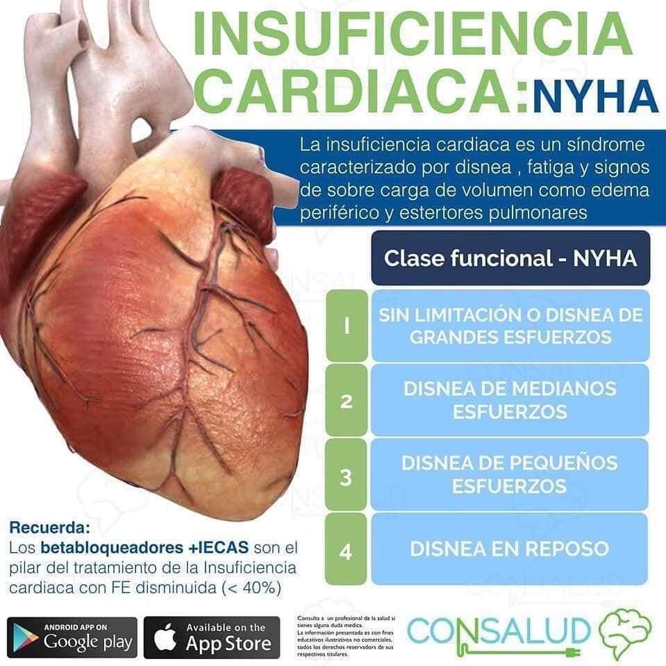 Josué Alain Hernández Rubio-5