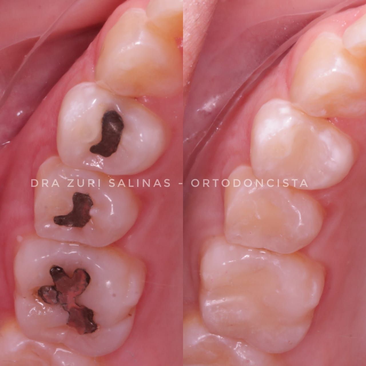 Zurisadai Salinas Chávez-6