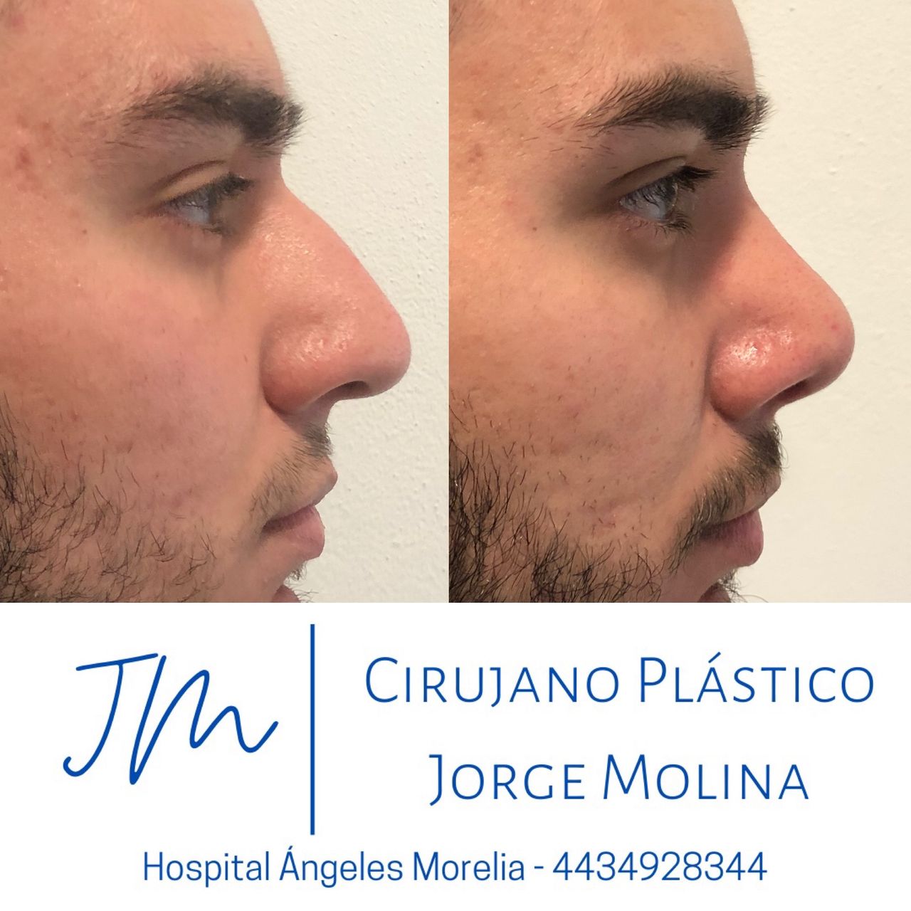 Jorge Eduardo Molina Ortega-11