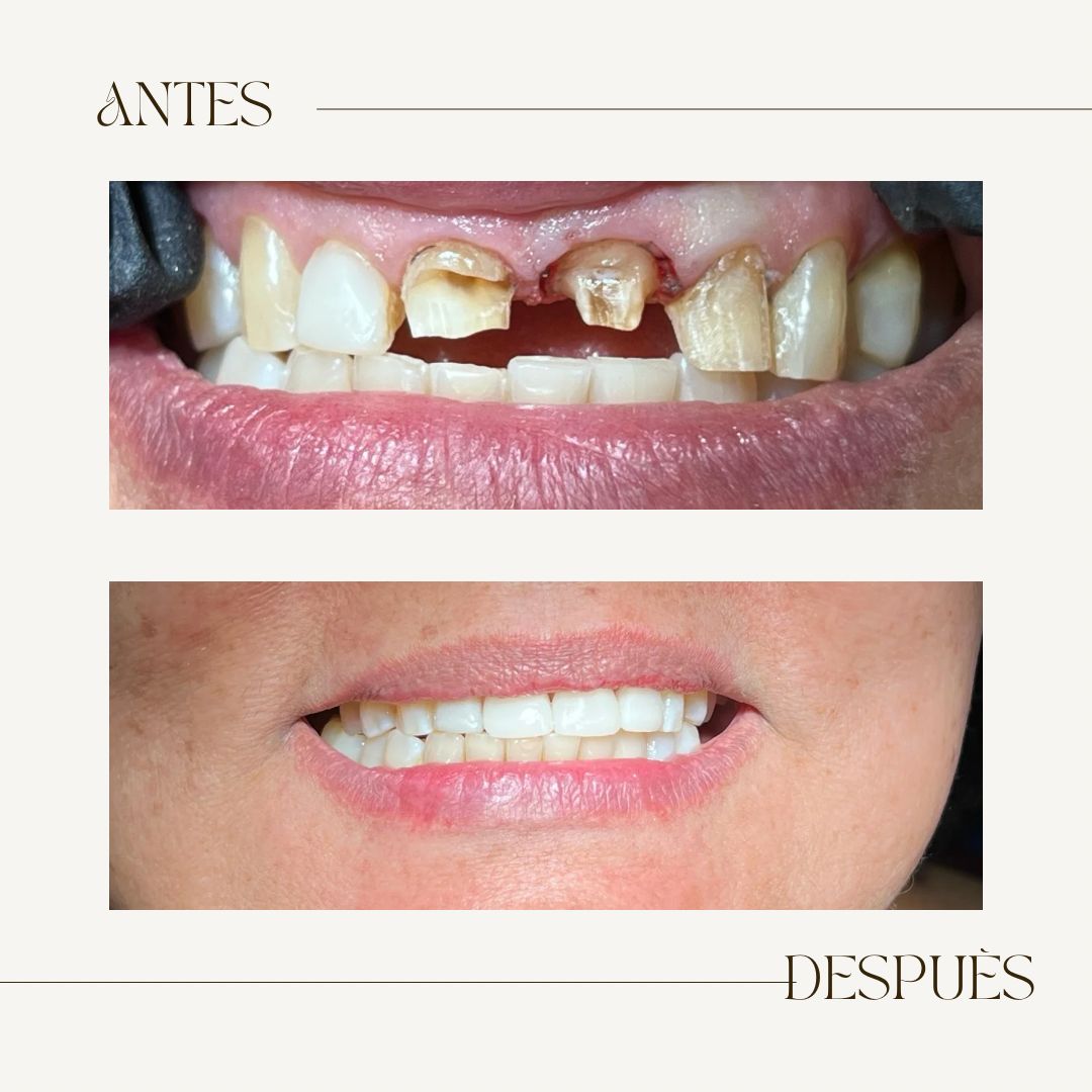 Noe Arturo Cortazar Sánchez-3