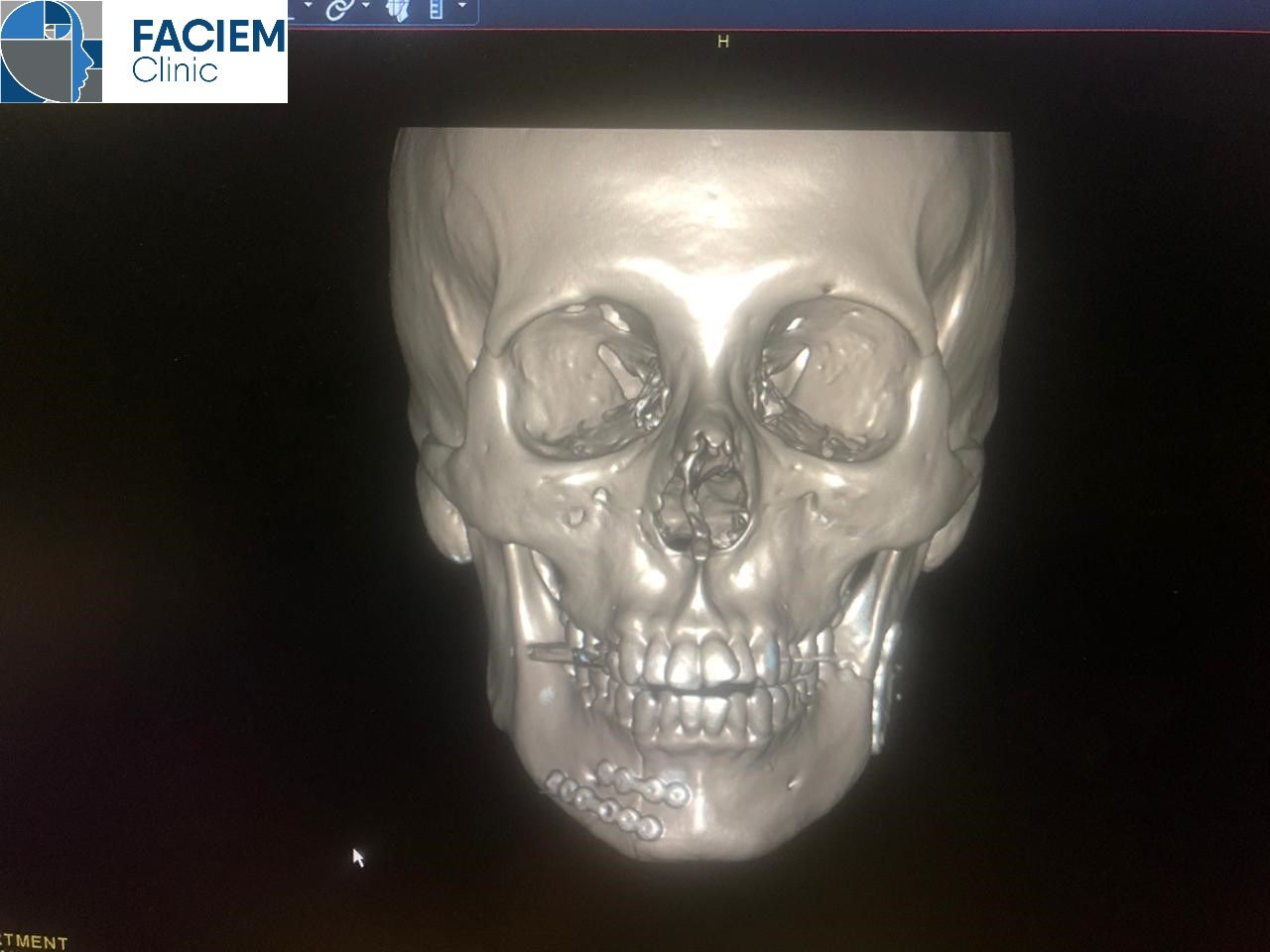 Arlen Colín Ordaz-26