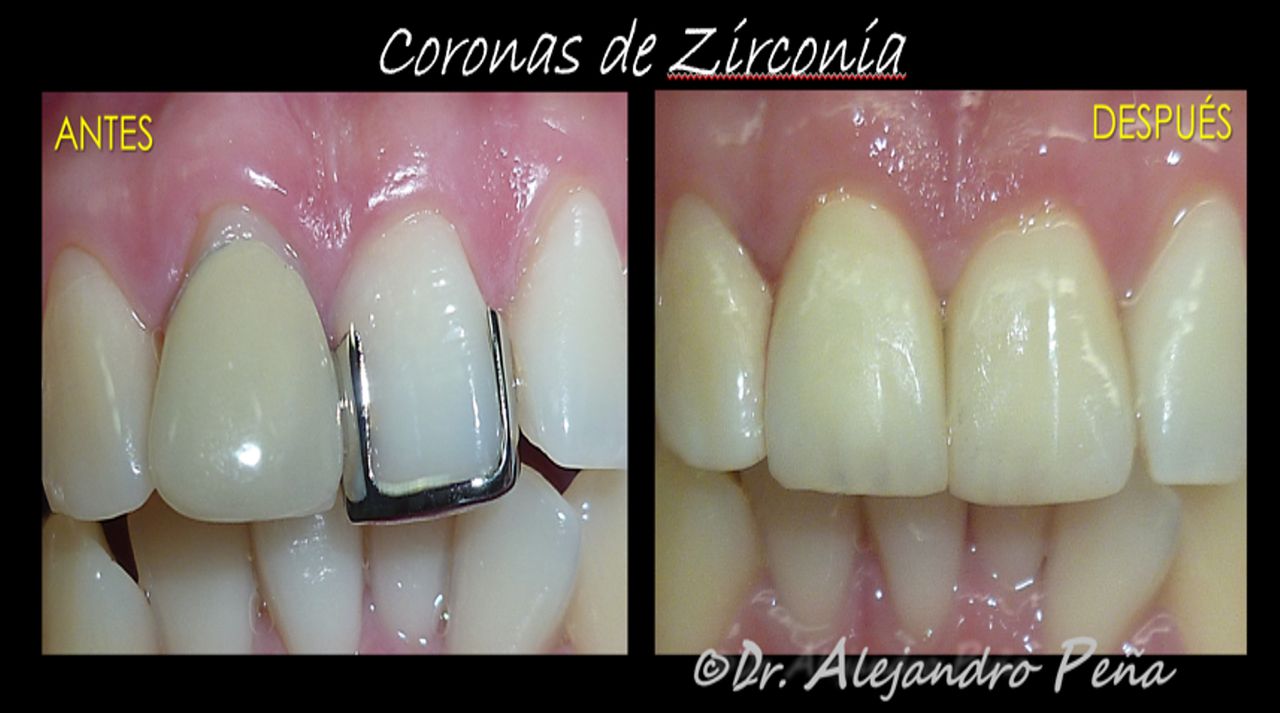 Alejandro Peña Vega-8