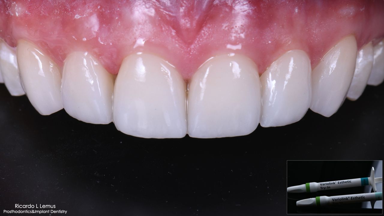 Ricardo López Lemus-116