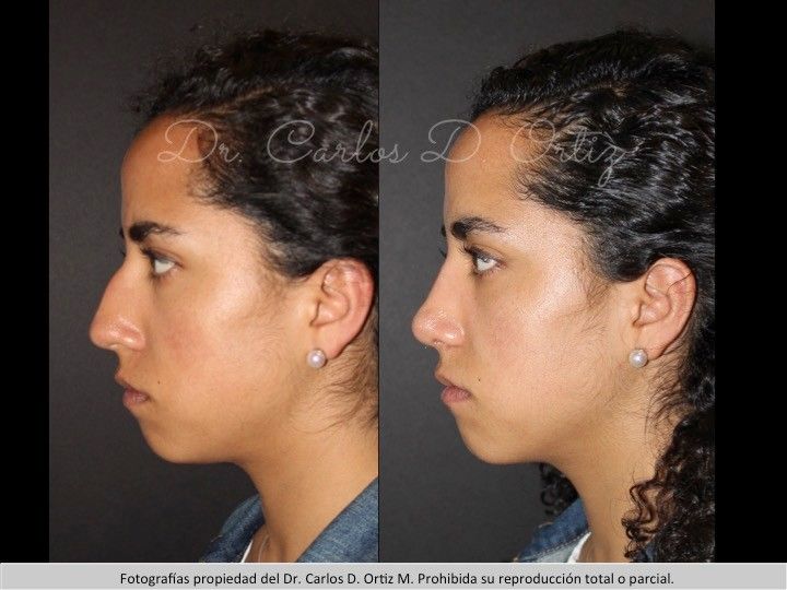 Carlos David Ortiz Moreno-65