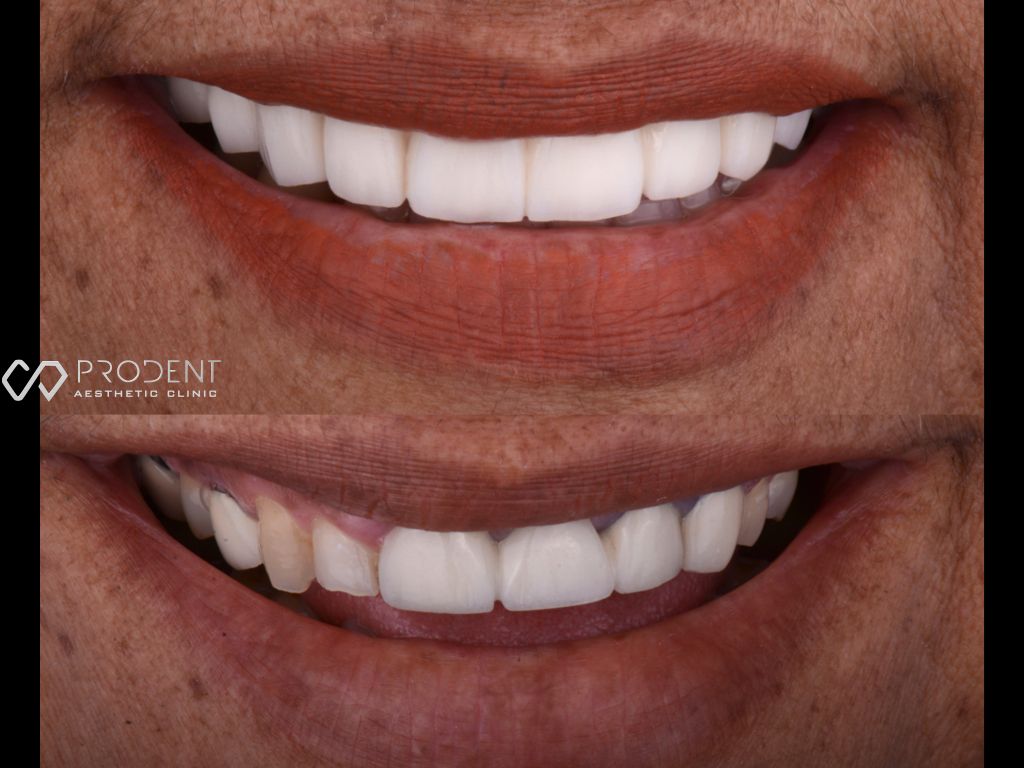 Ulises Pérez Murillo-91