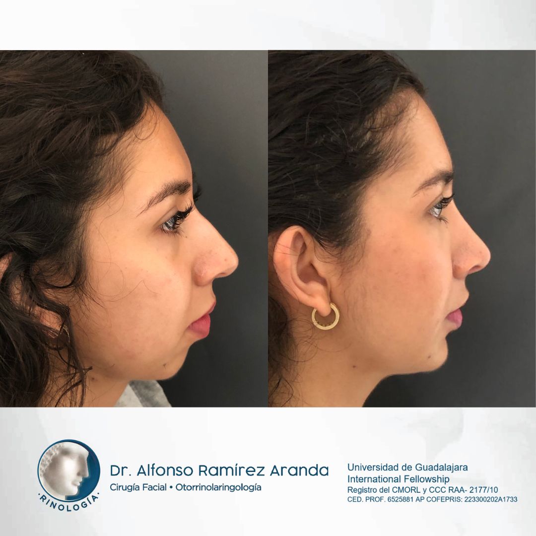 Alfonso Ramírez Aranda-16