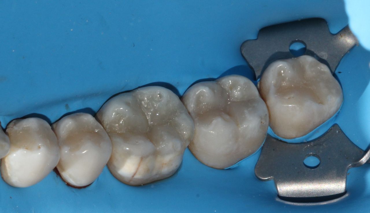 Karla Alvarez Treviño-8