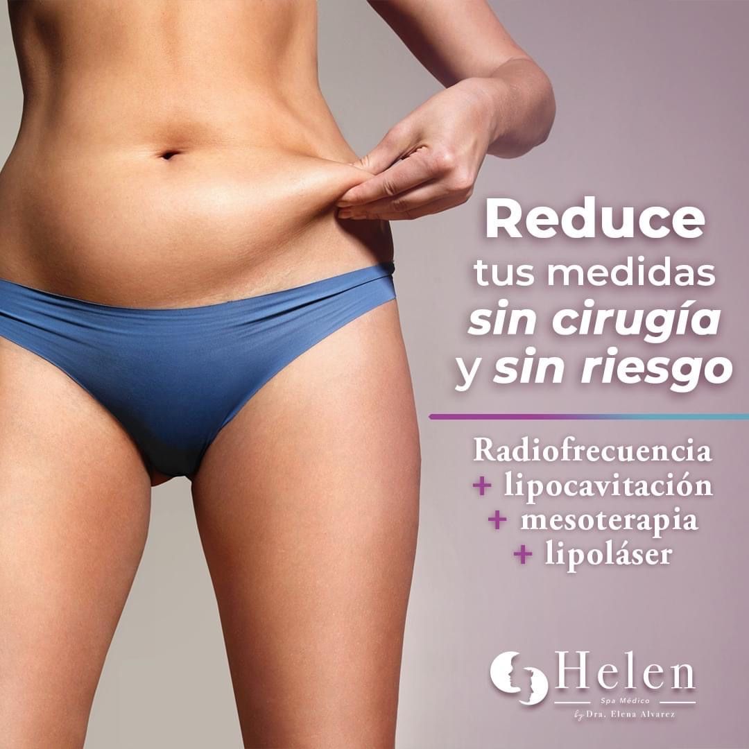 Elena Alvarez Velazquez-35