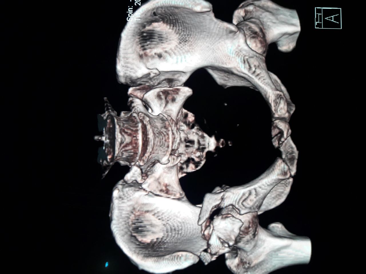 Jhon Jairo Galvis Bermudez-34