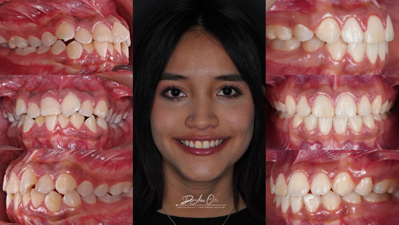 Alan Ortiz-7