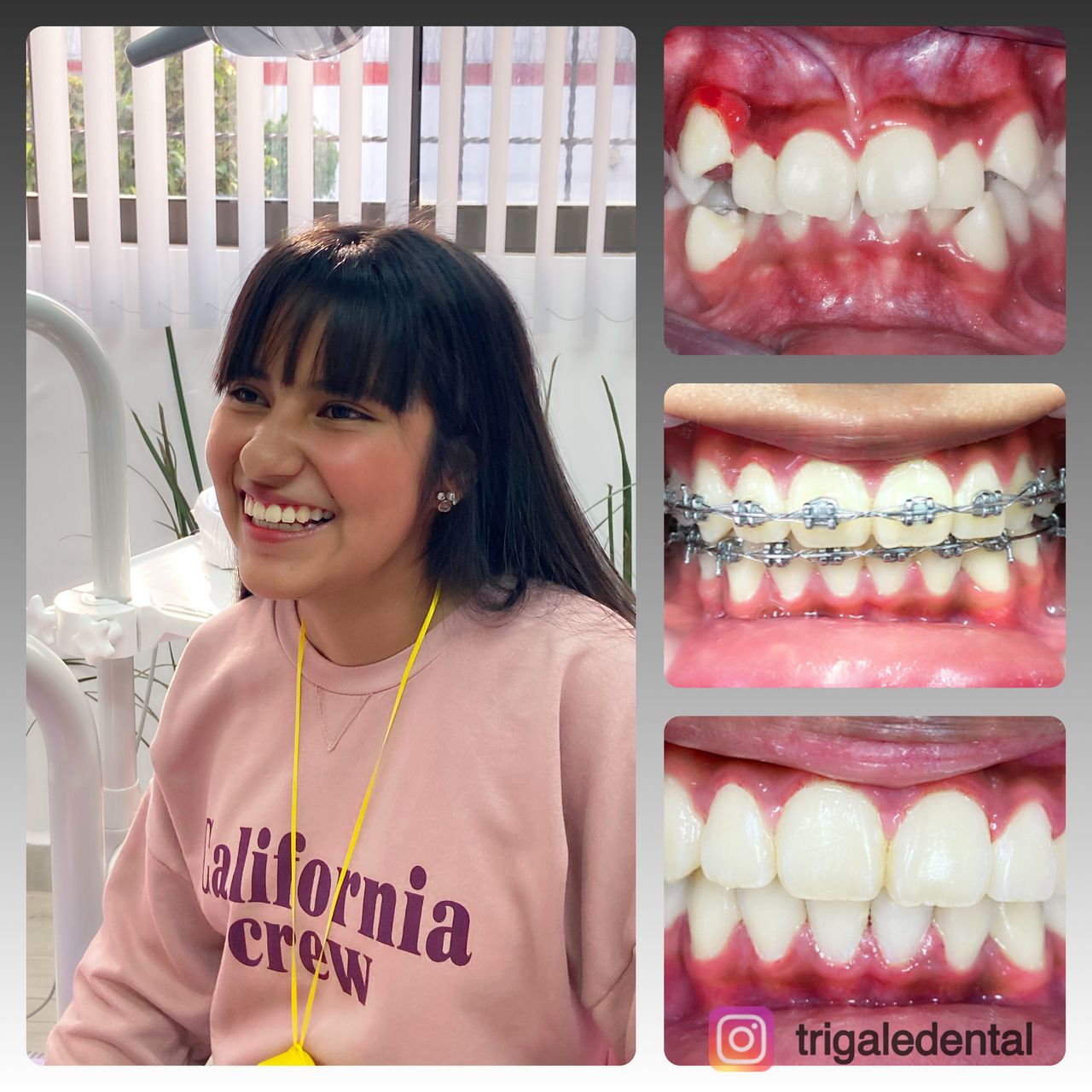 Rocío Gomez Castillo-17