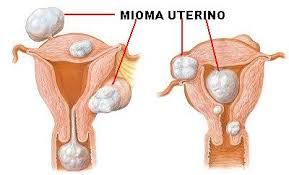 Francisco Xicoténcatl Rodriguez Quintero-6