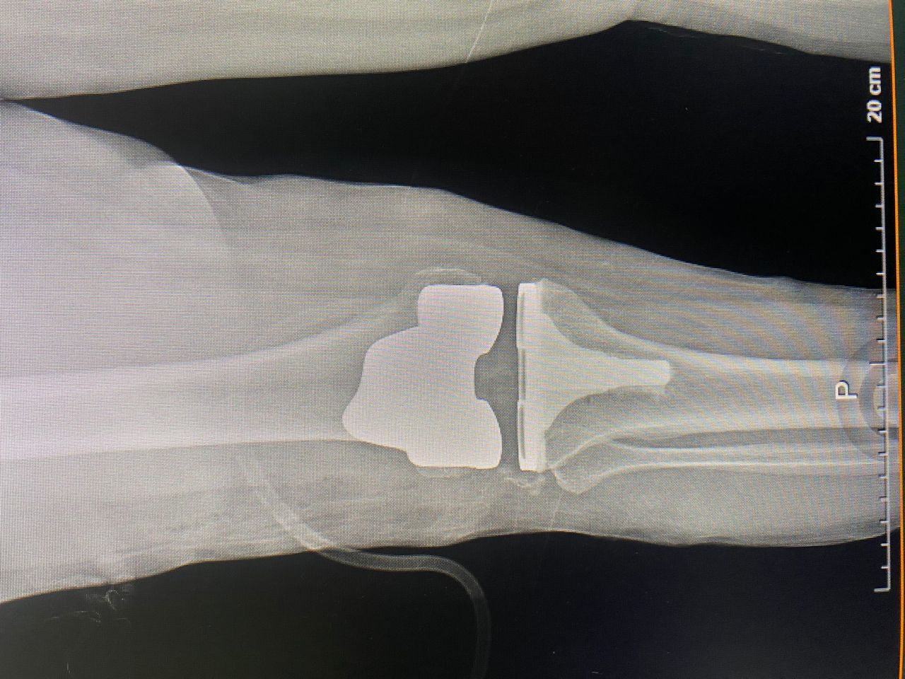 Carlos Humberto Vera Torres-6