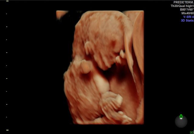 Graciela Elizabeth De La Torre Alvarez-17