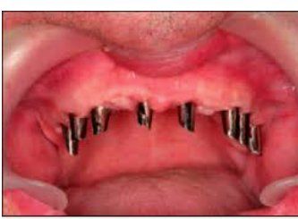 José  Luis Tapia Ibarra-11