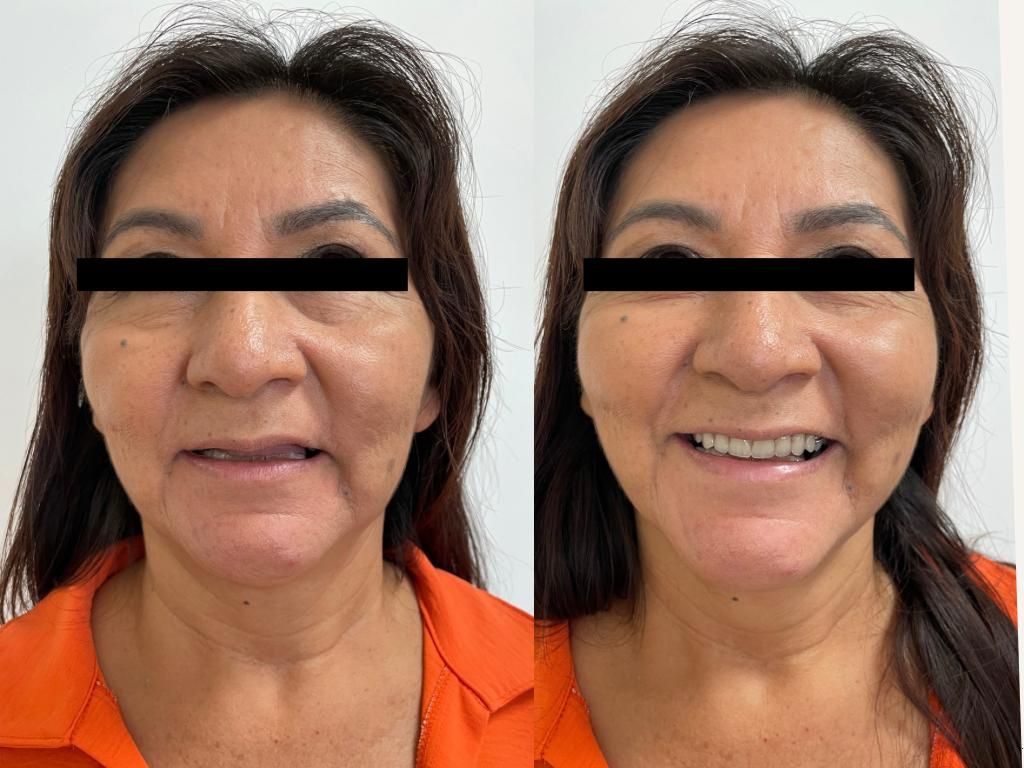 Ana Cecilia Chapa Kindling-4