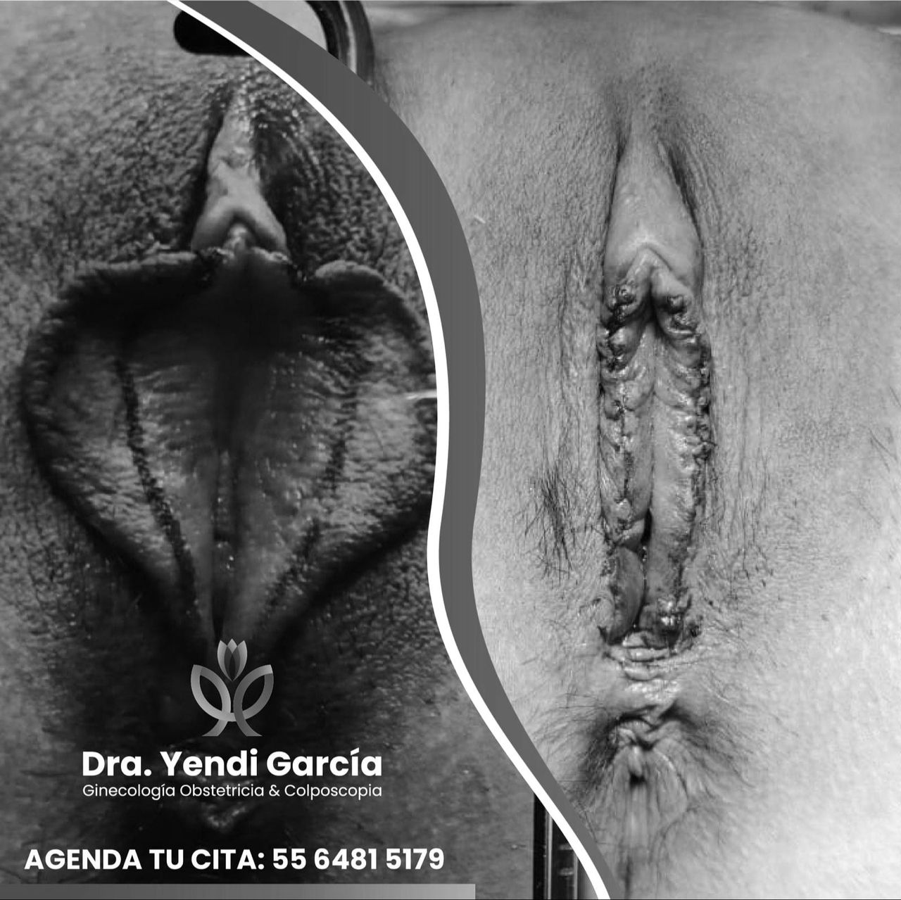 Yendi García Villa-10