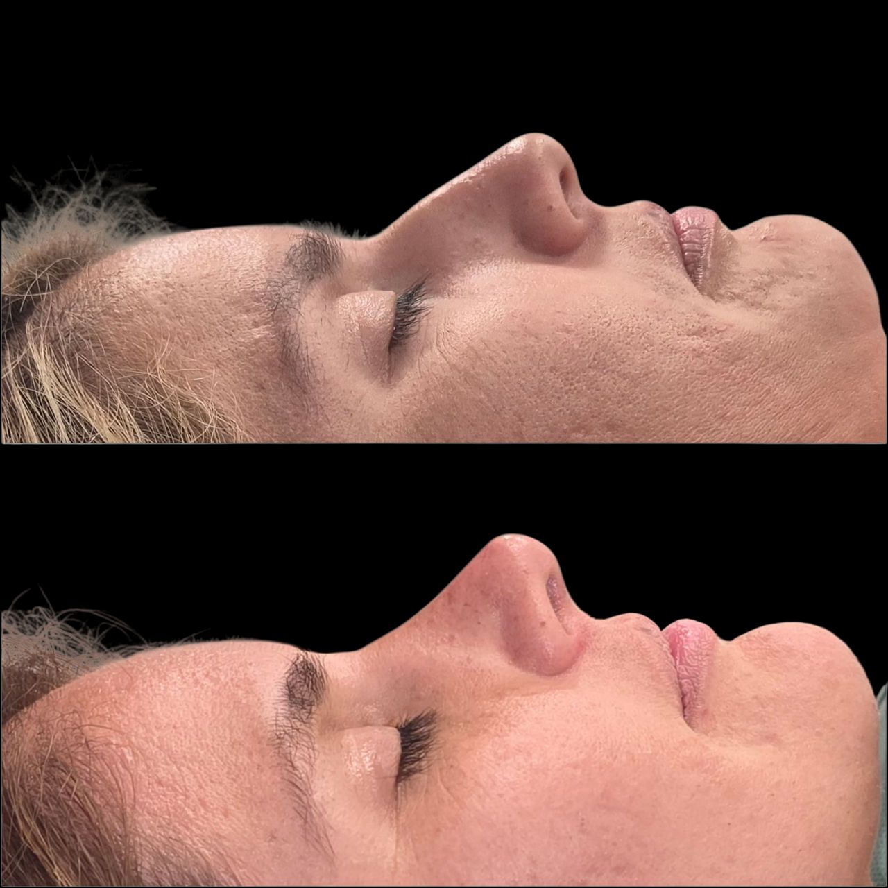 Kevin Matheus Flores Moraz-5