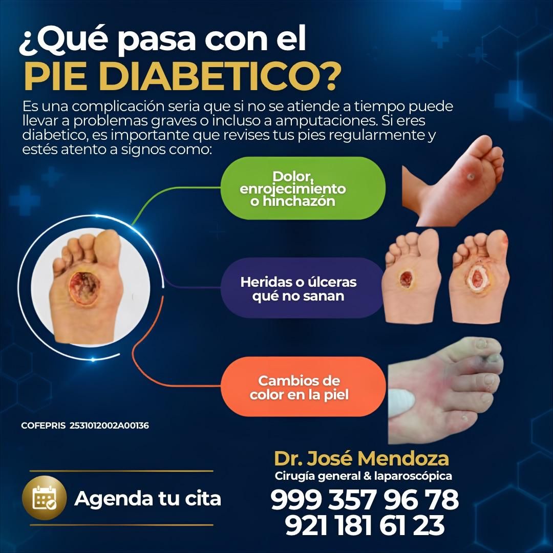 José De Jesus Mendoza Palomec-25