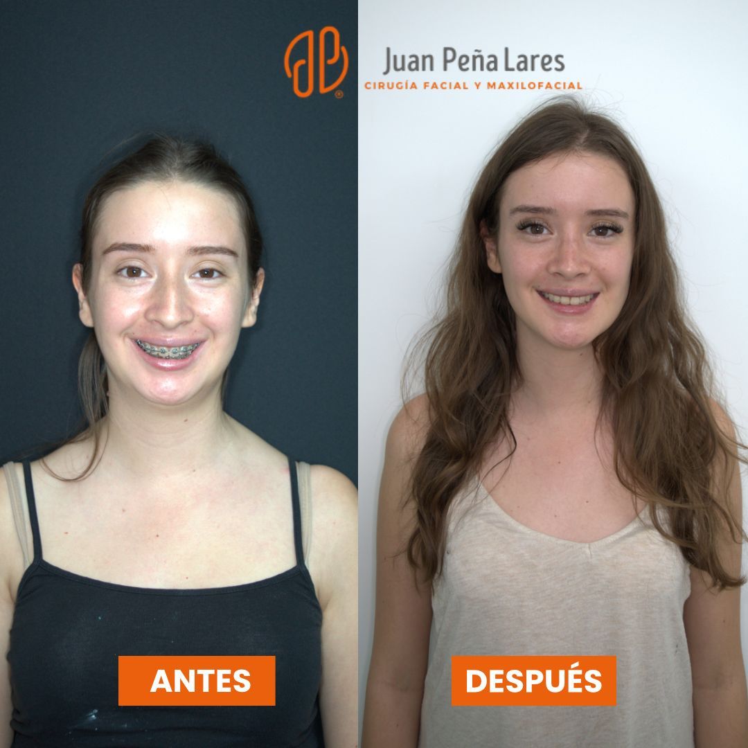 Juan Peña Lares-10