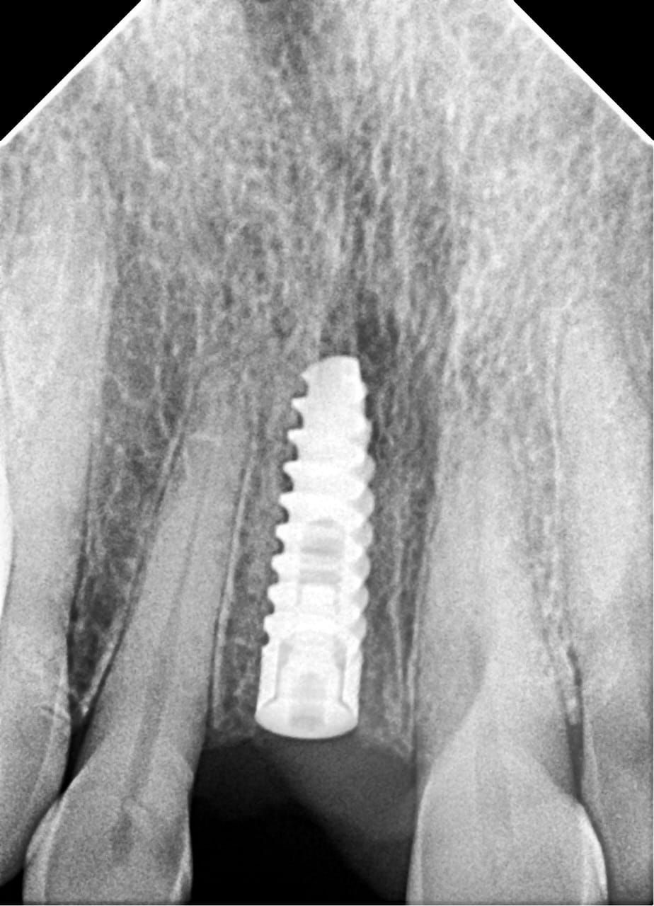 José Antonio Vázquez Mendoza-16
