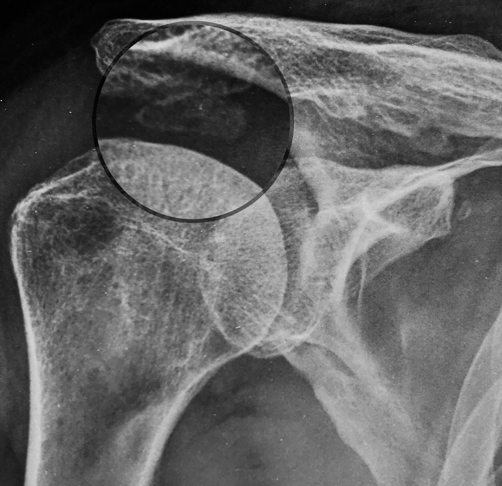 José A. Santana De Dios-0