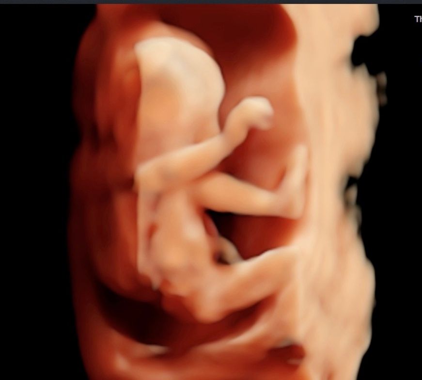 Blanca Esthela Rosales De La Garza-0