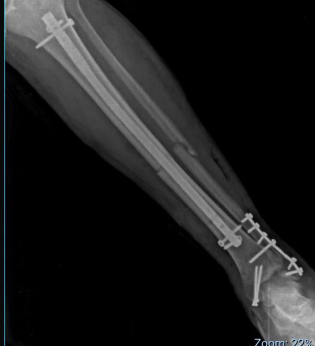 Abraham Gutiérrez Ávila-19