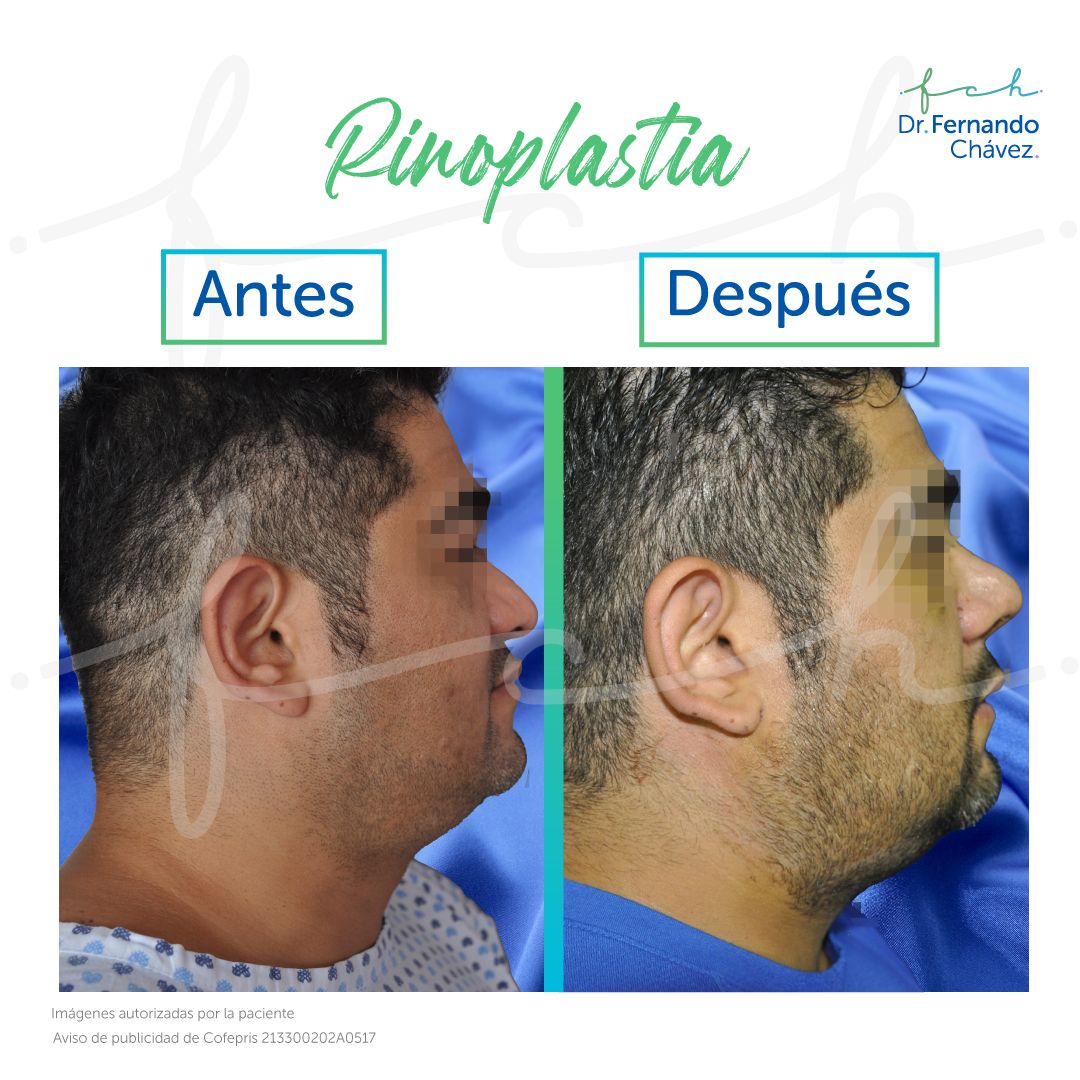 Fernando Chávez Osorio-29