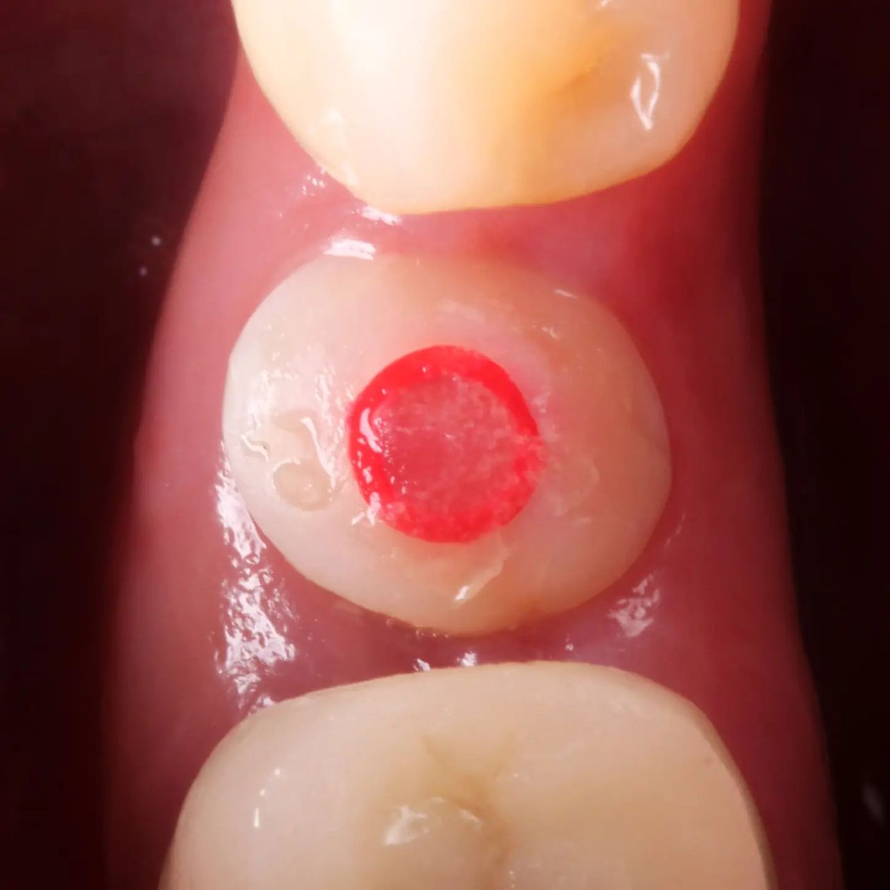 Hugo Enrique Aguilar Lamas-138