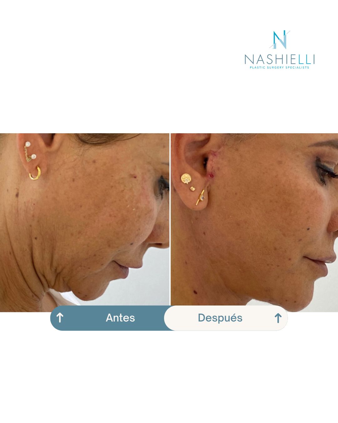 Nashielli Torres Espinosa Chiu-28