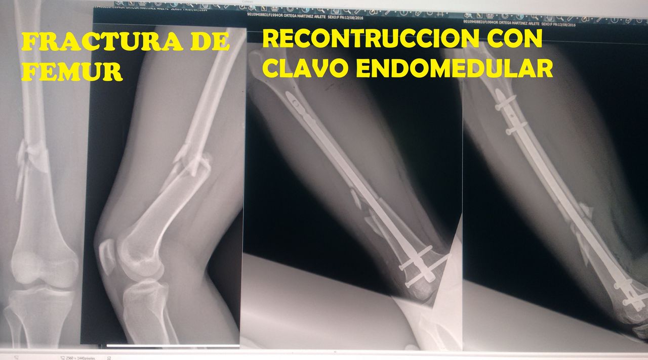 Gerardo Segundo Primero-11