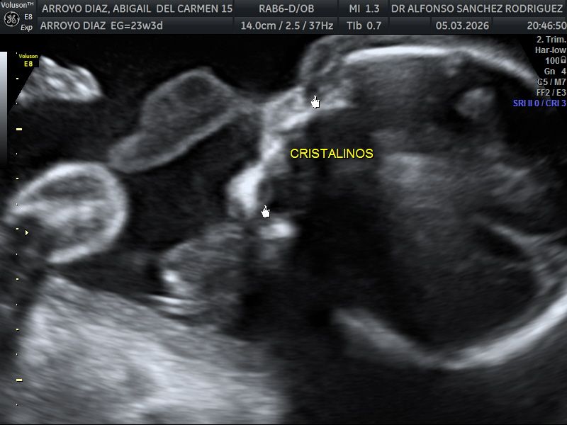 Alfonso Sanchez Rodriguez-61