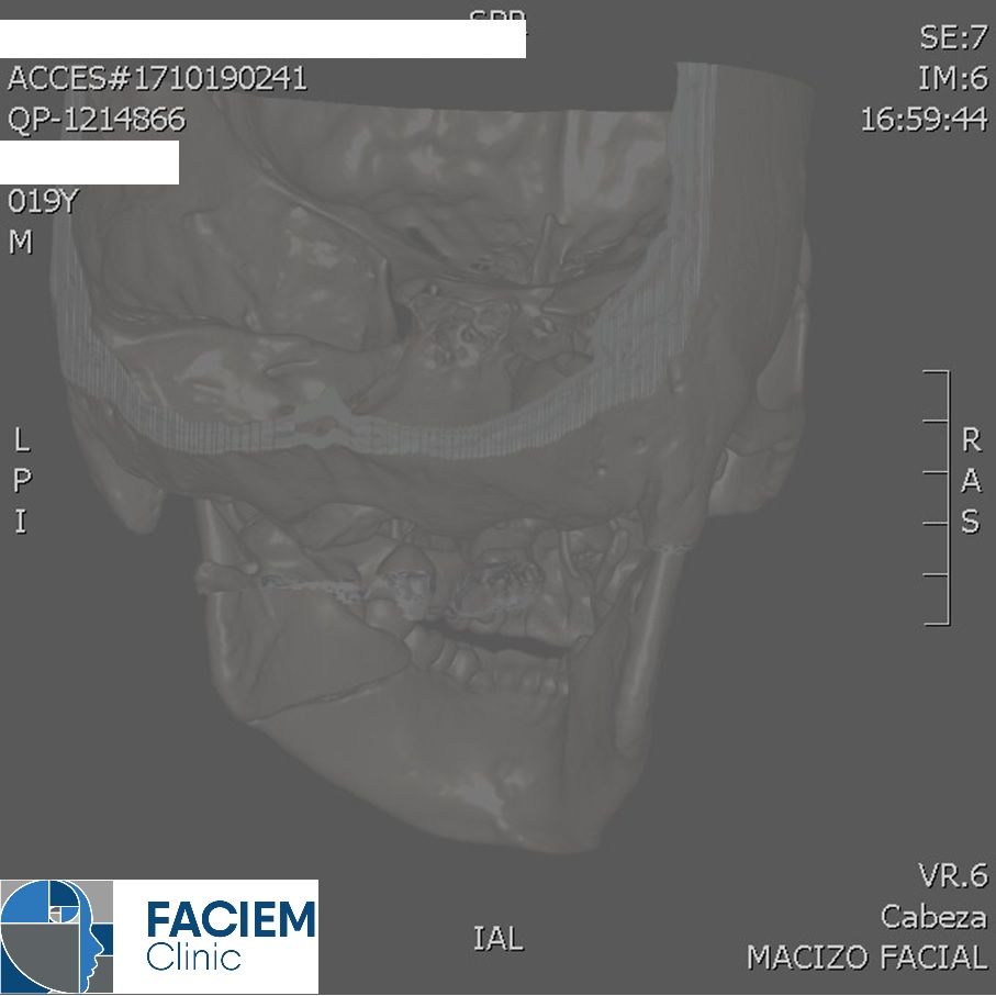 Arlen Colín Ordaz-43