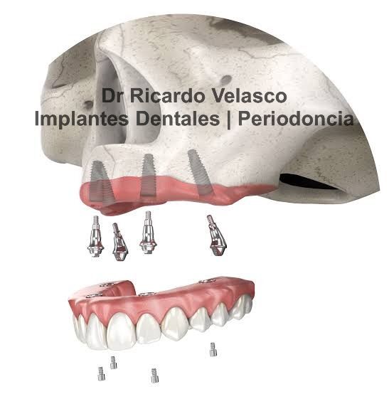 Ricardo Velasco Avelar-32